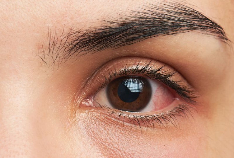 Retinopat�a diab�tica �Qu� es?