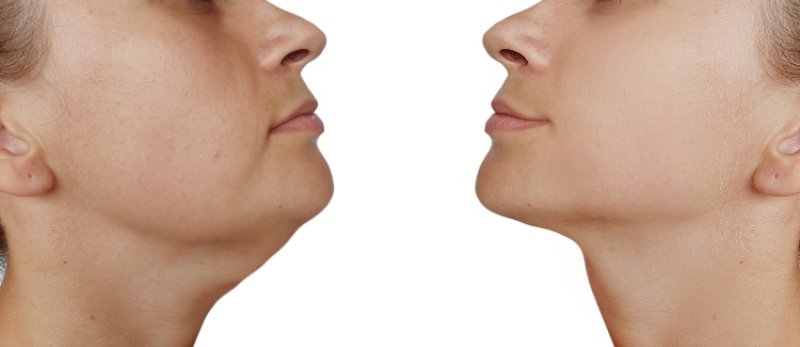 �Qu� es el doble ment�n?