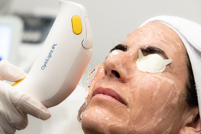 sindrome-de-ojos-secos