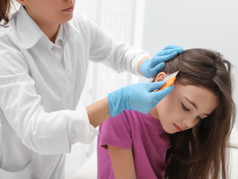 C�mo quitar los piojos y prevenir su aparici�n