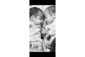 Del 17 al 22 de noviembre: Exposicin fotogrfica del recin nacido prematuro