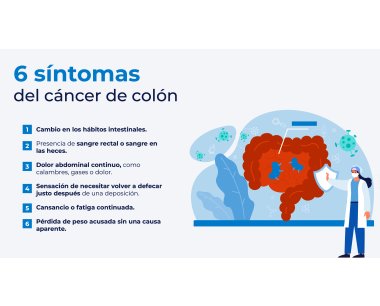 Seis sntomas que alertan de la posibilidad de un cncer de colon.